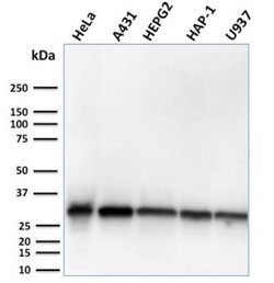 MTAP Antibody (MTAP/3137R) - Azide and BSA Free, Novus Biologicals 100 &mu;g | Buy Online | Novus Biologicals | Fisher Scientific